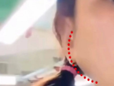 42岁陈意涵称医美后脸歪了，吓得求助ChatGPT