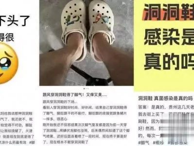 洞洞鞋竟是“真菌培养皿”?专家:夏日热销鞋暗藏健康风险男子车祸致女友截瘫,事后全家跑路,聊天记录曝光,真相不简单