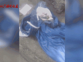女子水中捡漂亮石头装裤兜里被烧伤,医生:“石头”初步判定是磷